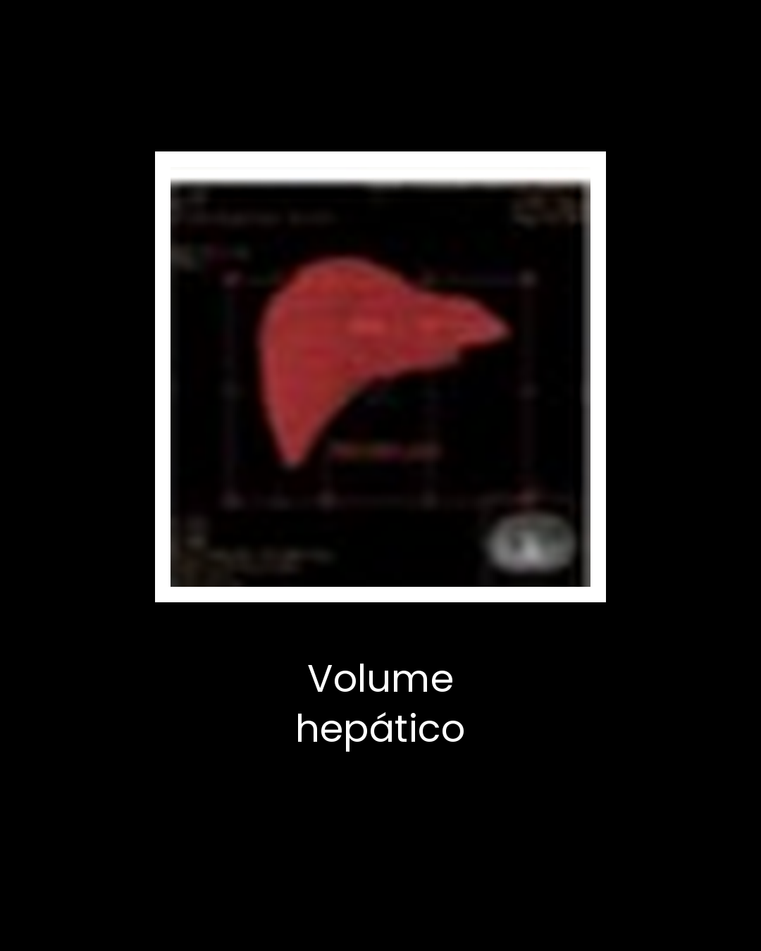 03-volume-hepatico