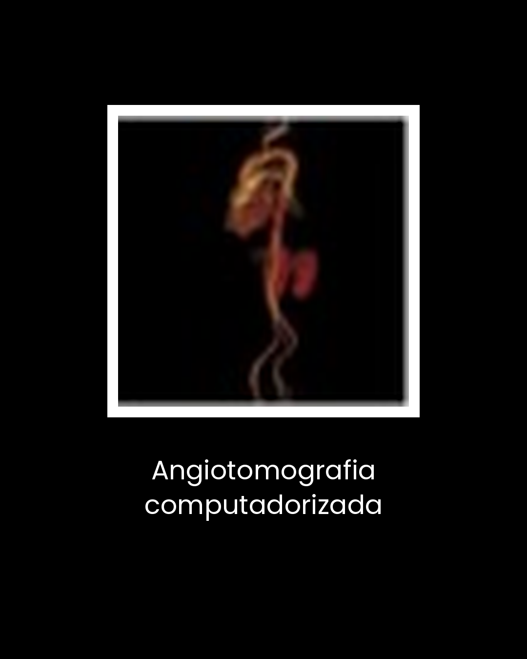 04-angiotomografia-computadorizada