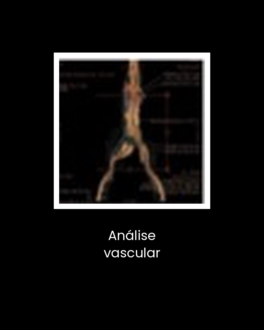 06-analise-vascular