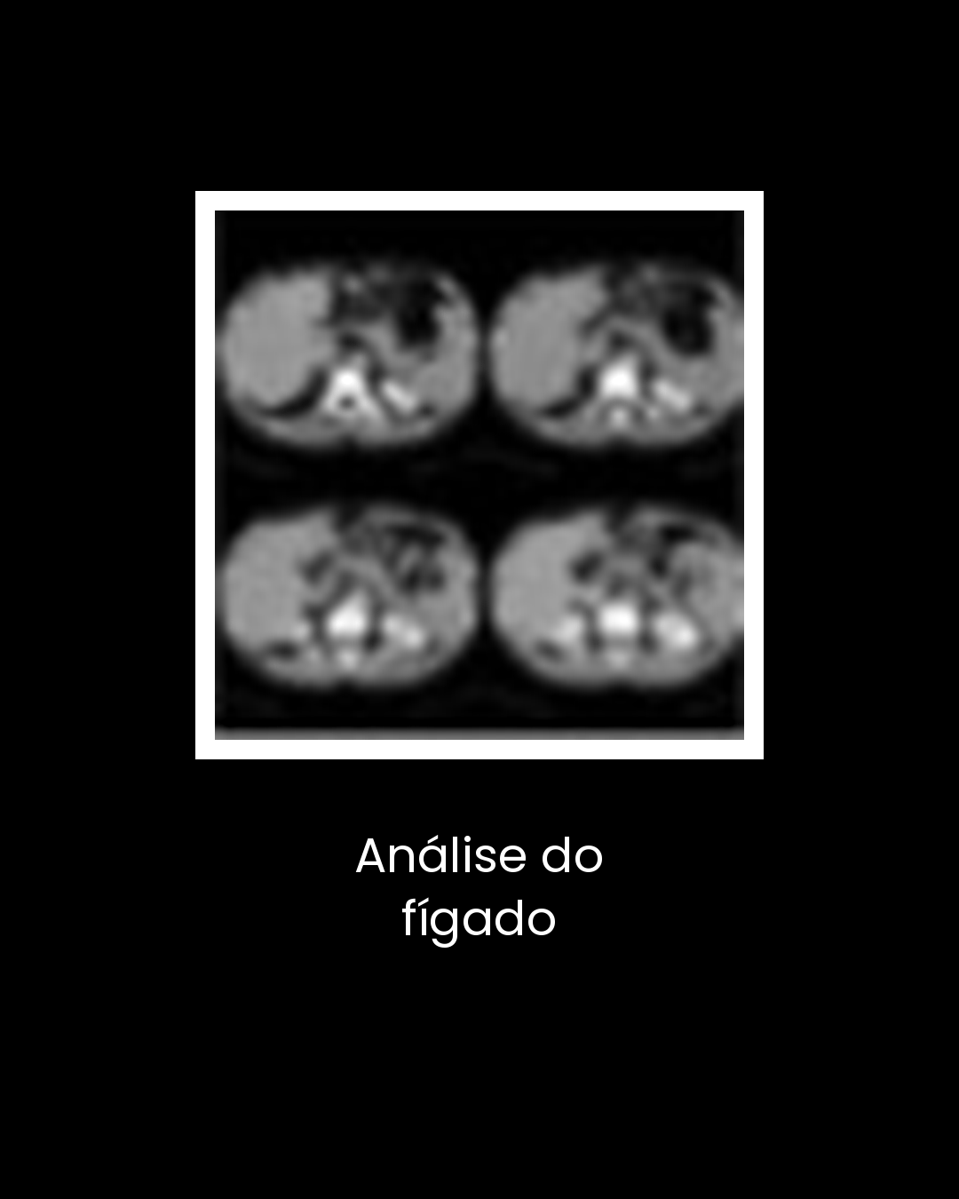 09-analise-do-figado