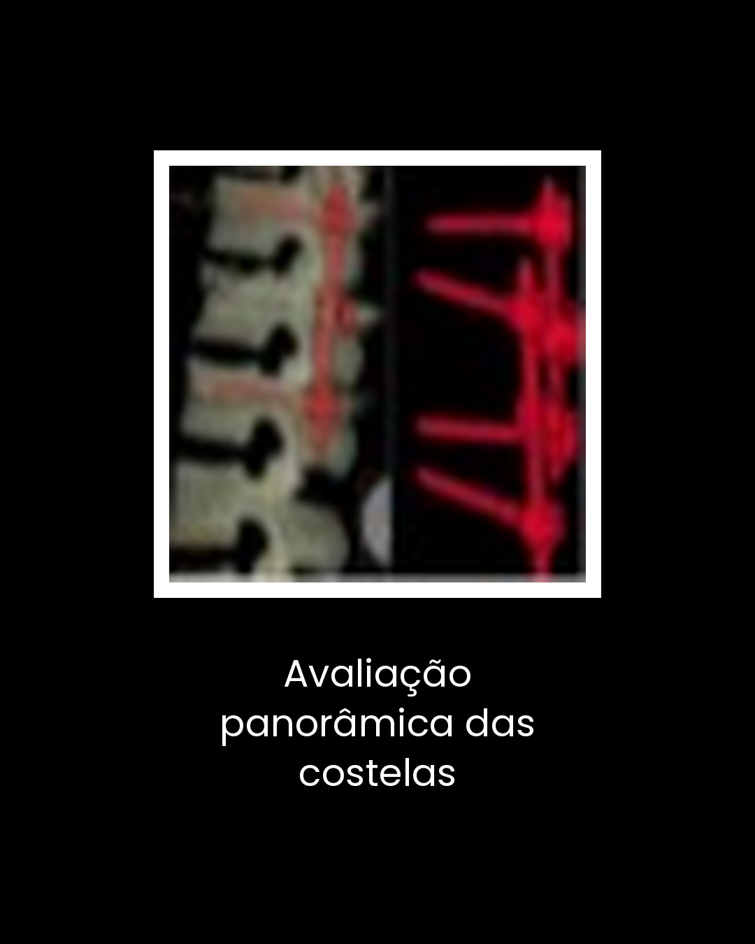 10-avaliacao-panoramica-das-costelas