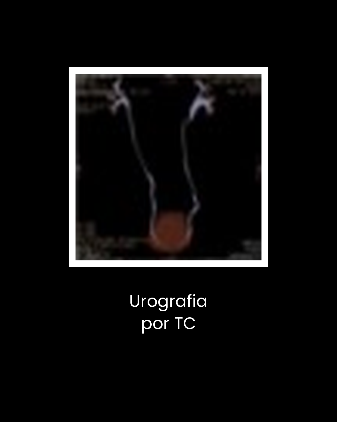 11-urografia-por-tc