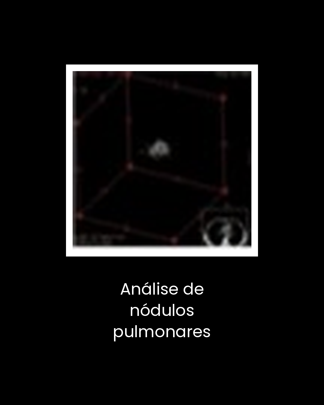 14-analise-de-nodulos-pulmonares