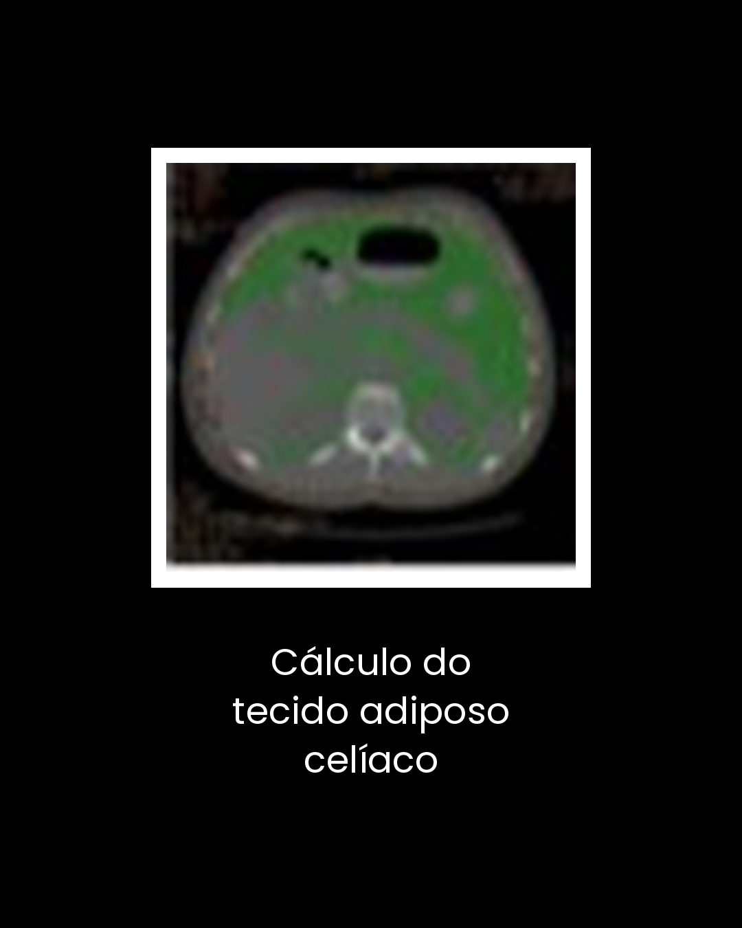 15-calculo-do-tecido-adiposo-celiaco