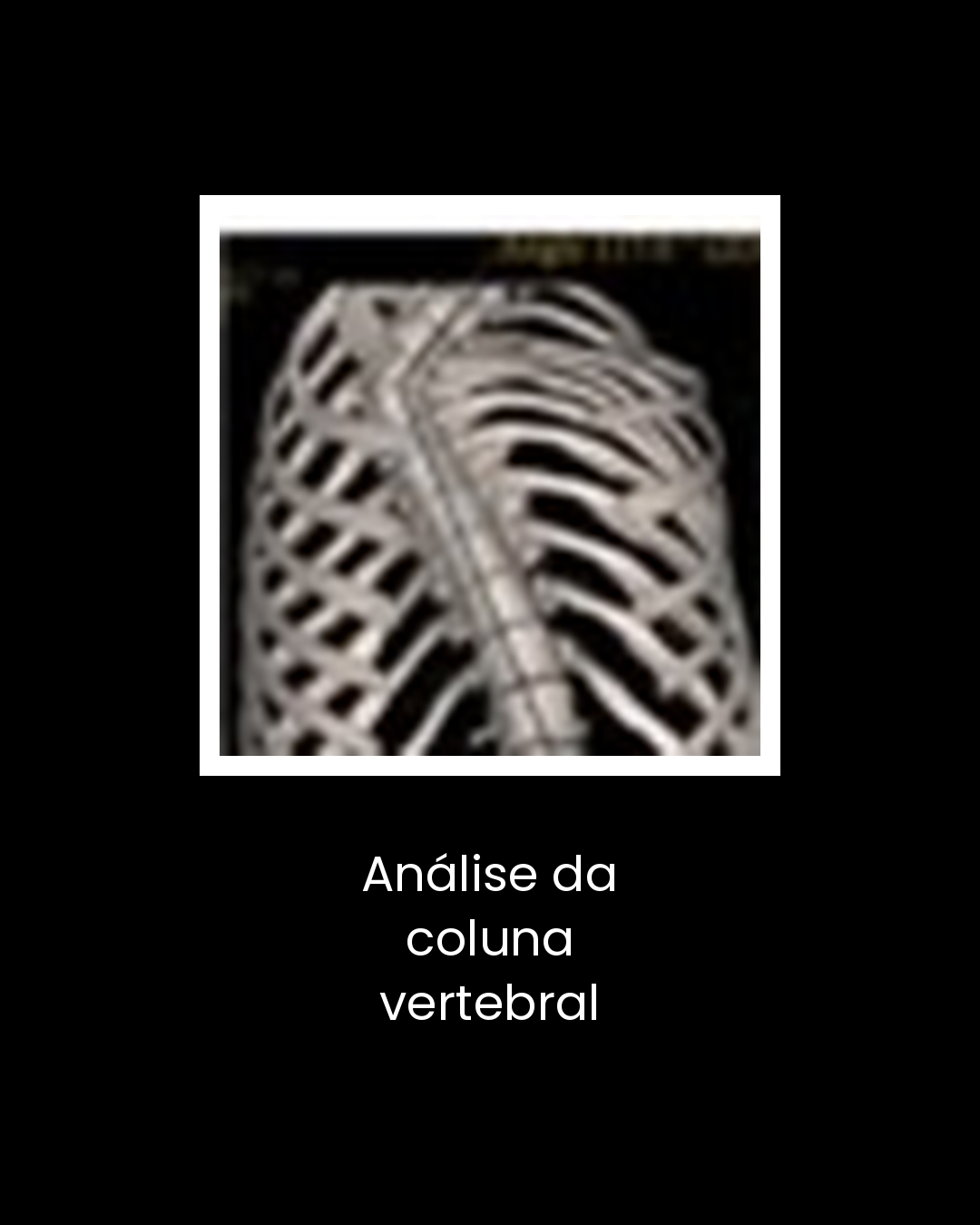 16-analise-da-coluna-vertebral