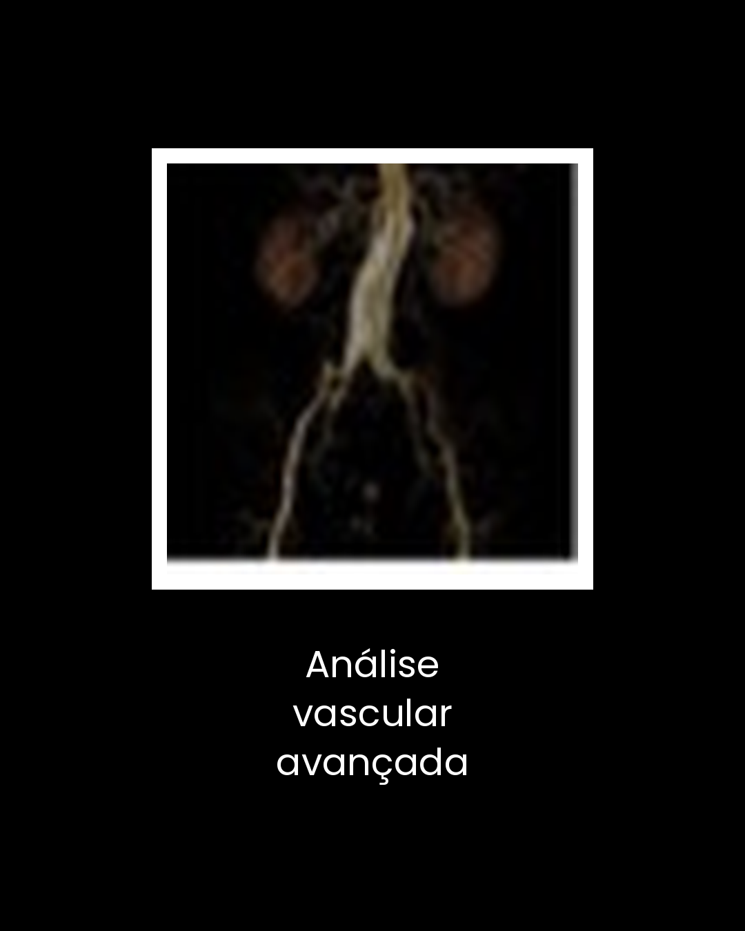 18-analise-vascular-avancada
